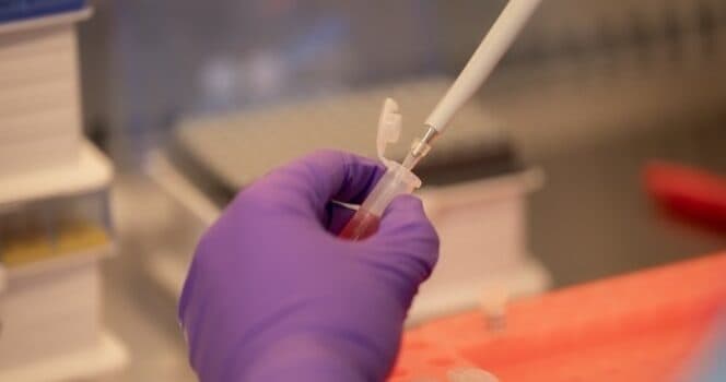 CGT Catapult supporting VascVersa to develop pre-treatment test to ensure efficacy of cell therapy that regenerates blood vessels