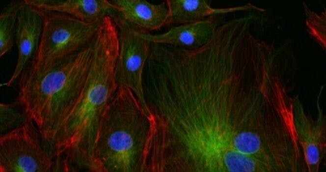 Stem cell therapies: can anything stop them now?
